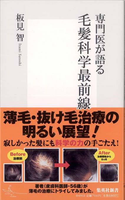ハゲに悩む : 劣等感の社会史 | 新書マップ4D